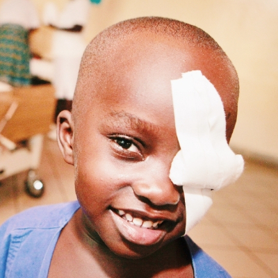 Smiling child with an eye bandage after treatment, representing pediatric eye care, vision recovery, and accessible healthcare services.